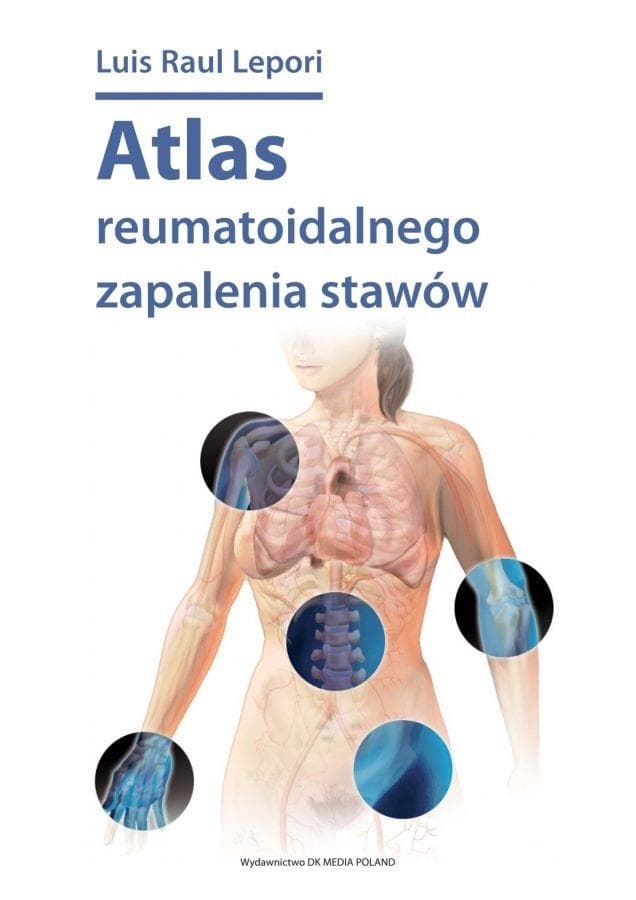 Atlas reumatoidalnego zapalenia stawów DK Media Poland 75 stron
