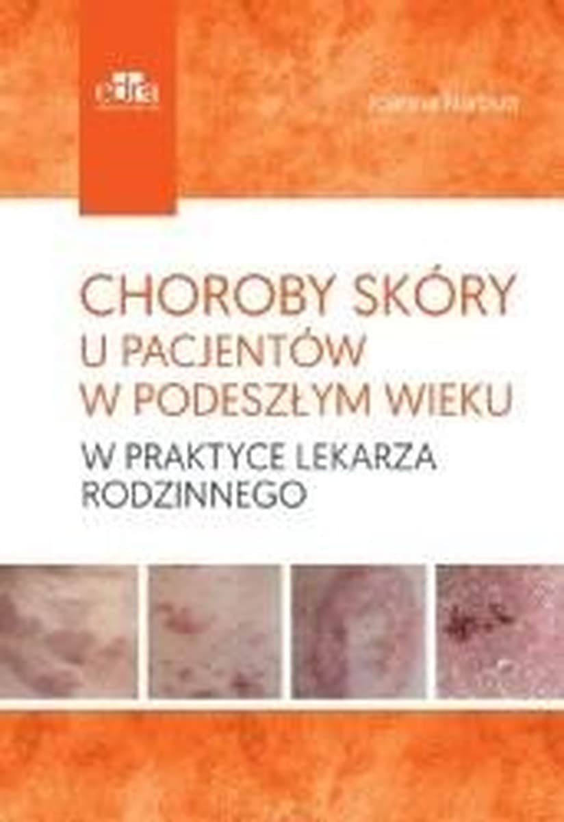 Choroby skóry u pacjentów w podeszłym wieku - poradnik lekarza