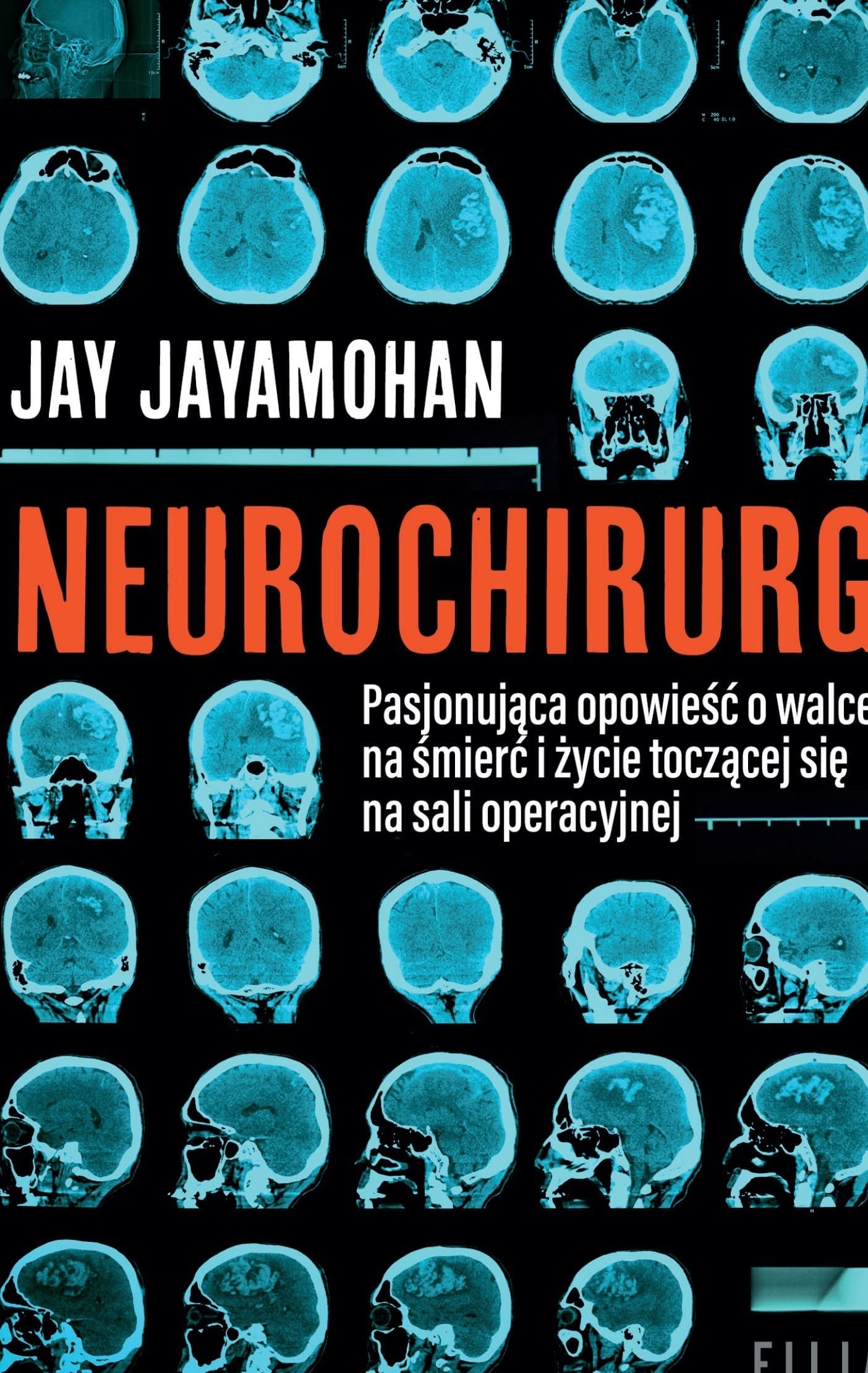 Neurochirurg wyd. 2