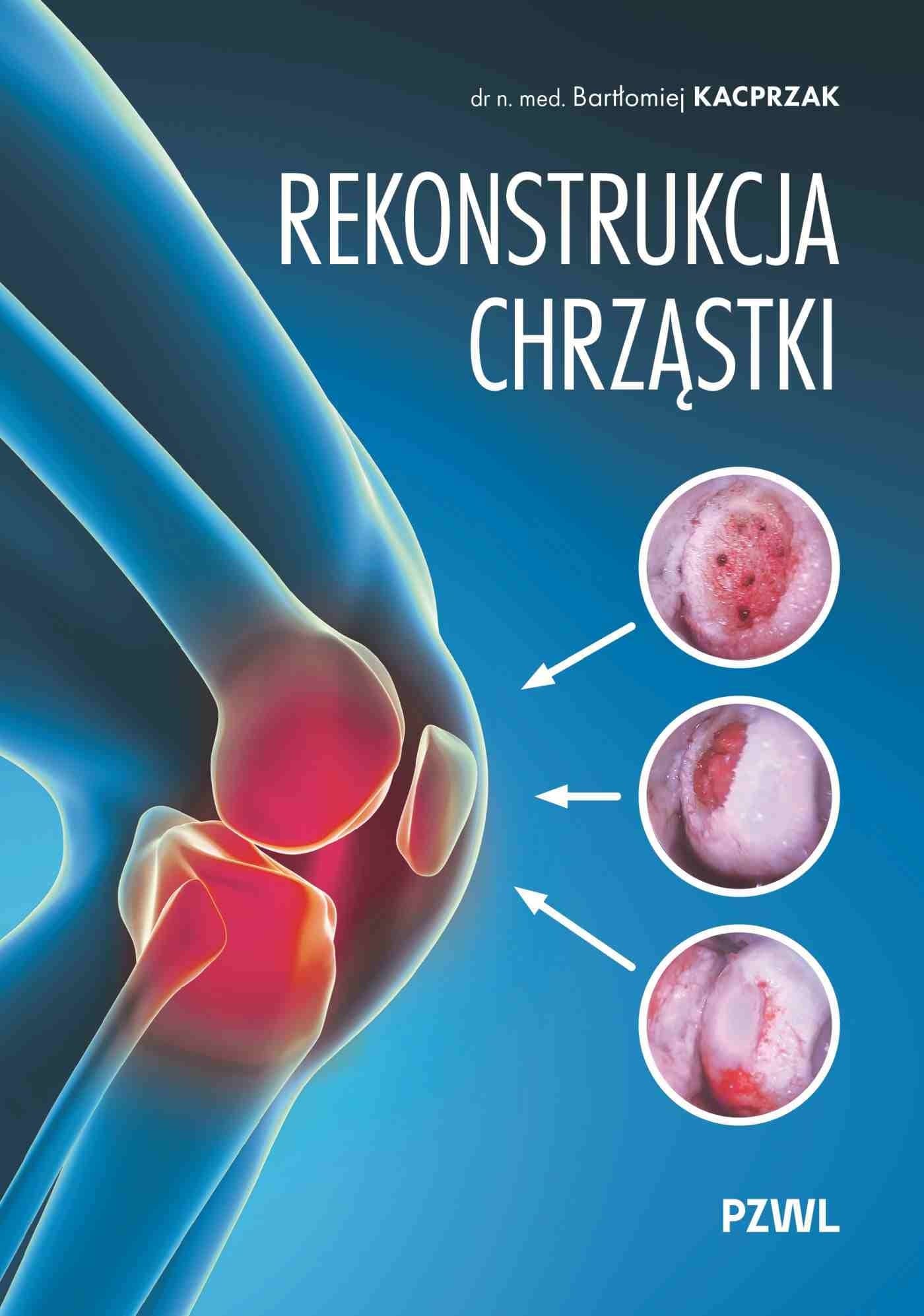 Rekonstrukcja chrząstki. Ratujemy kolano