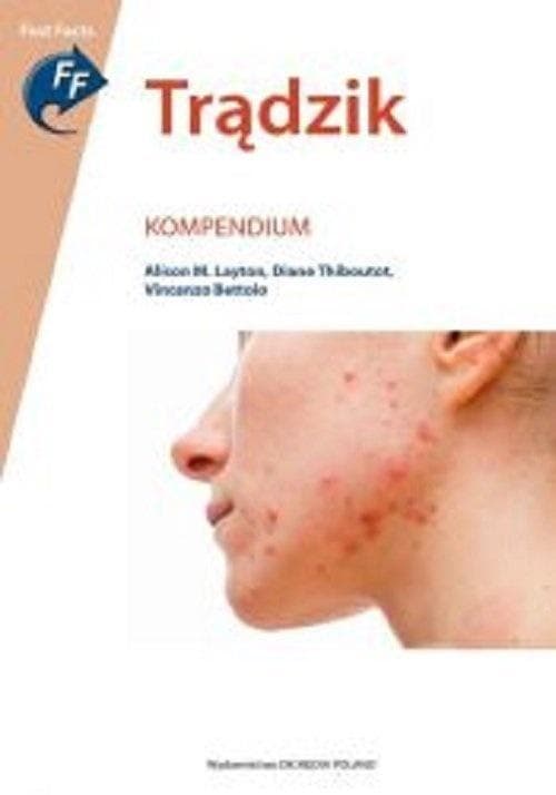 Trądzik. Kompendium - aktualny stan wiedzy medycznej