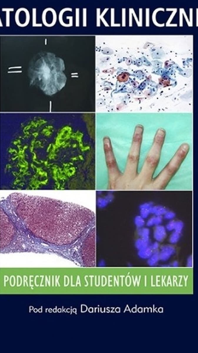 Wybrane zagadnienia patologii klinicznej